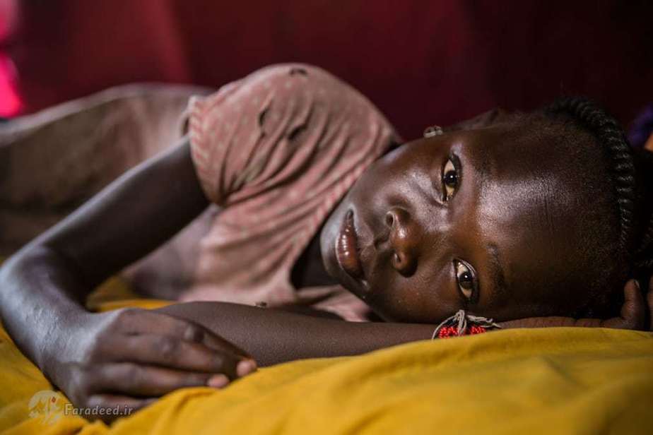 جوبا، سودان جنوبی: آنجیلا آنیا مبتلا به صرع که در پمناهگاه کودکان آواره بستری شده است. 
